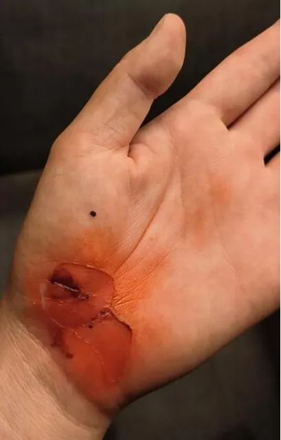 “这件事,可千万别告诉爸妈!” “这件事,可千万别告诉爸妈!”