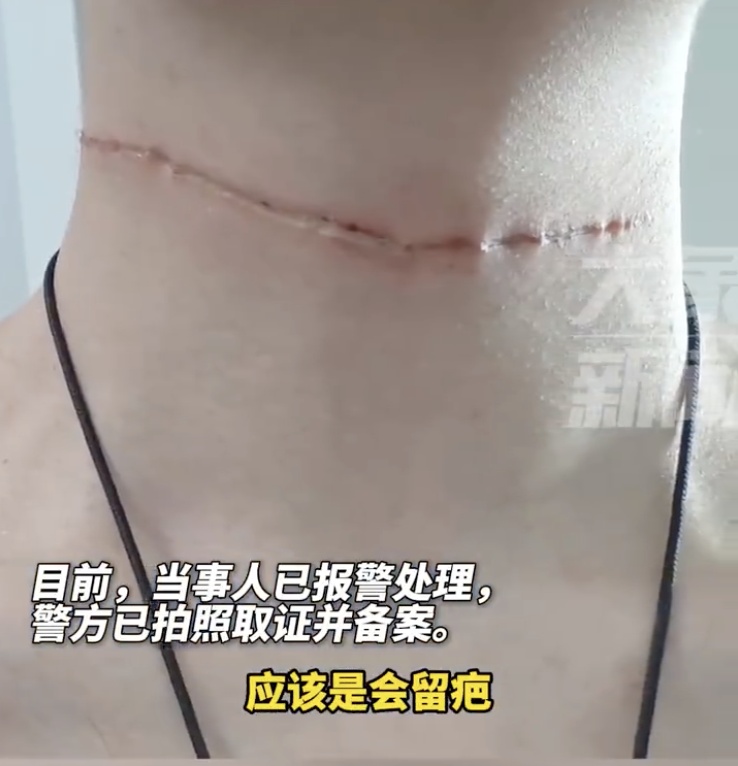 2天连发3起，有人惨遭“割喉”！正是高发期