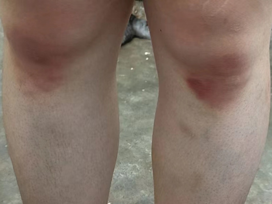 “这件事,可千万别告诉爸妈!” “这件事,可千万别告诉爸妈!”