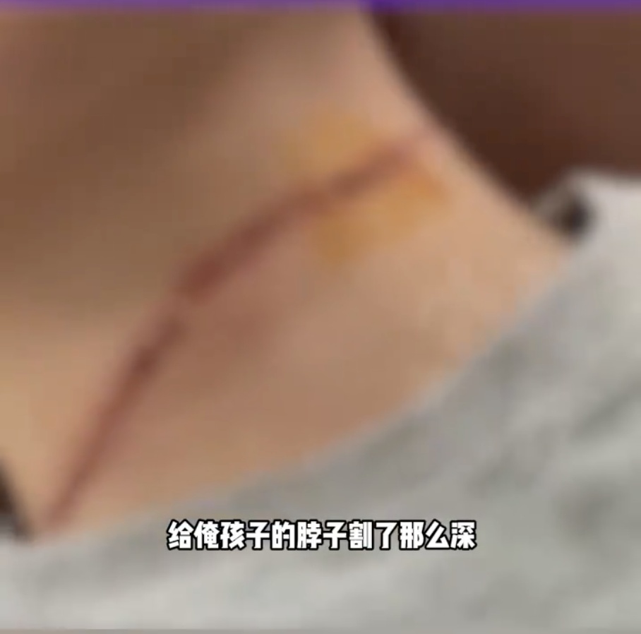 2天连发3起，有人惨遭“割喉”！正是高发期