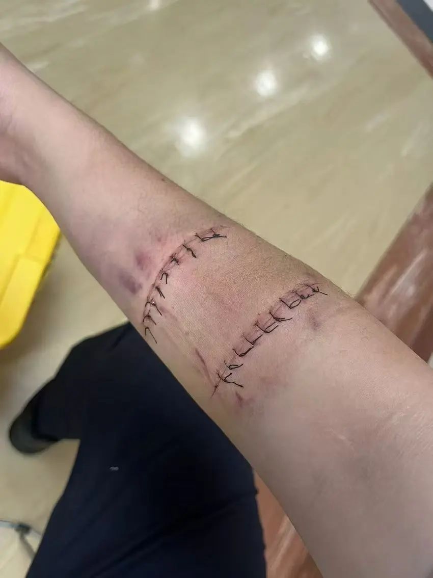 “爸爸，你疼吗？”