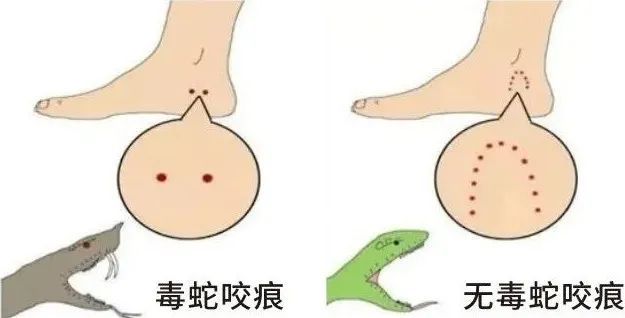 剧毒！即将进入高发期，千万别学电视里……