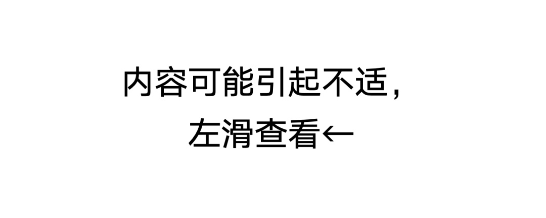 舌苔厚跟舌苔薄的人,到底谁更健康?结果竟然是…… 舌苔厚跟舌苔薄的人,到底谁更健康?结果竟然是……