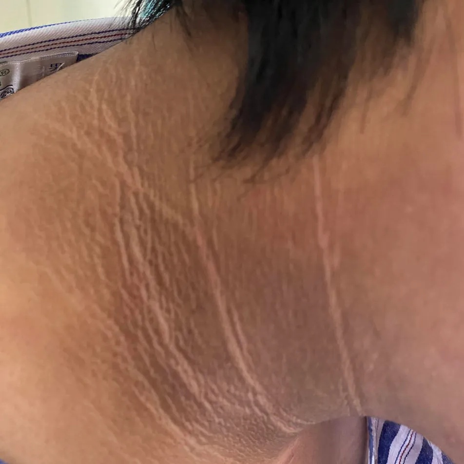 脖子“洗不干净”,或是身体发出危险信号 脖子“洗不干净”,或是身体发出危险信号