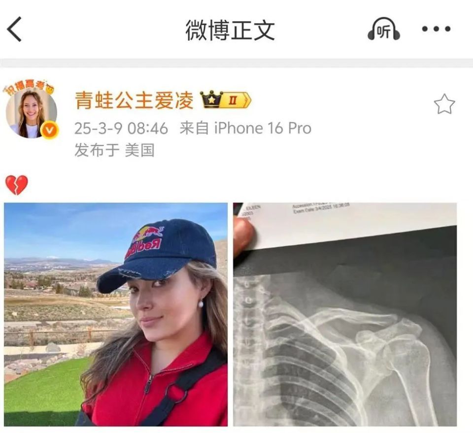 谷爱凌肩部骨折后首次更新动态：标志性微笑再现