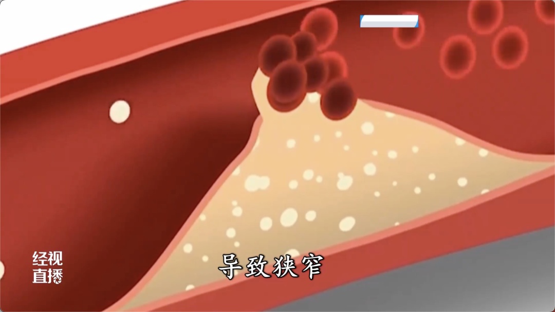 连续6小时!武汉58岁男子突然倒地……这个爱好很多人有,医生紧急提醒 连续6小时!武汉58岁男子突然倒地……这个爱好很多人有,医生紧急提醒