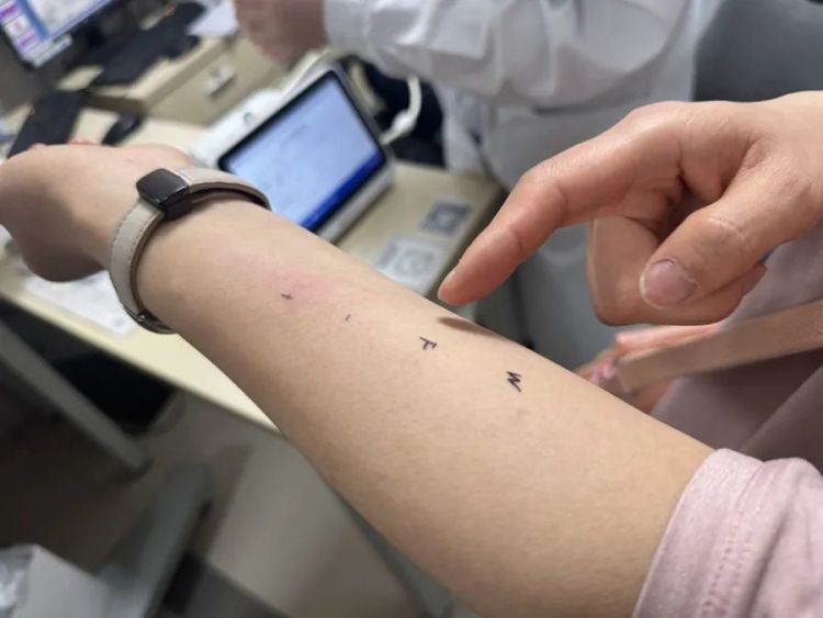 发病后急剧恶化,男子差点窒息!近期高发,很难根治!张文宏发声谈过敏 发病后急剧恶化,男子差点窒息!近期高发,很难根治!张文宏发声谈过敏