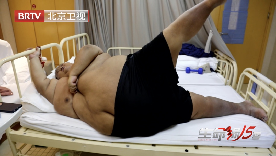 33岁小伙因抑郁暴饮暴食体重涨至718.8斤，一顿能吃25个包子！现减至198公斤