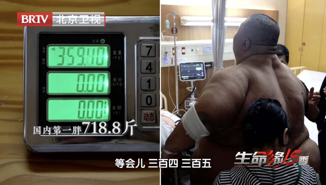 冲上热搜！718斤“中国第一胖”，半年狂减300斤