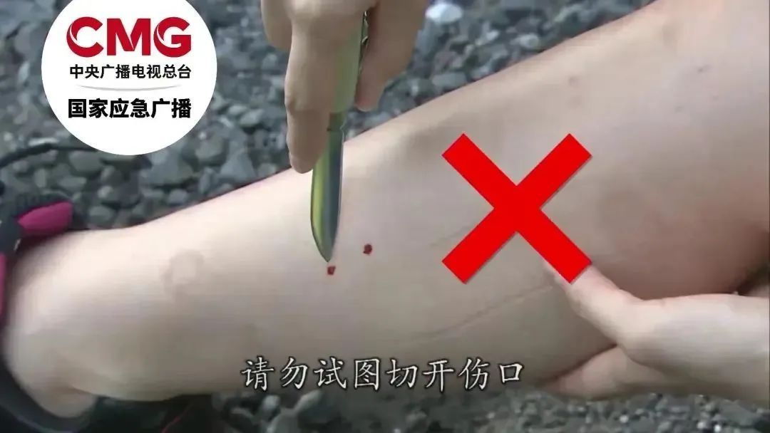 被咬一口肿到发黑!假期出游请注意,严重可致命 被咬一口肿到发黑!假期出游请注意,严重可致命
