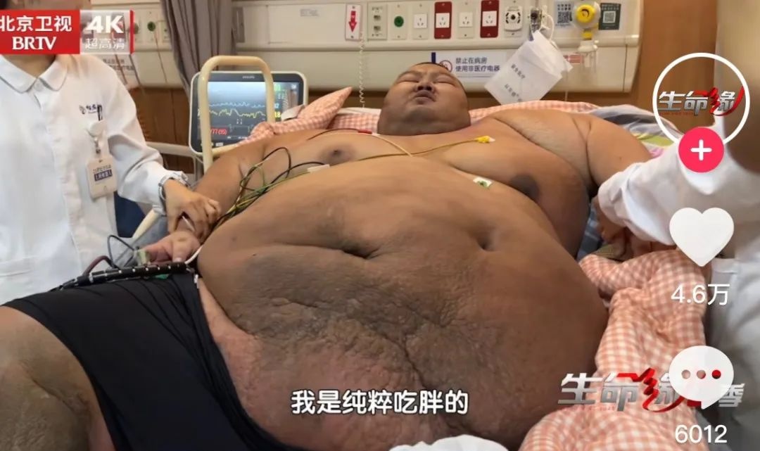 冲上热搜！718斤“中国第一胖”，半年狂减300斤
