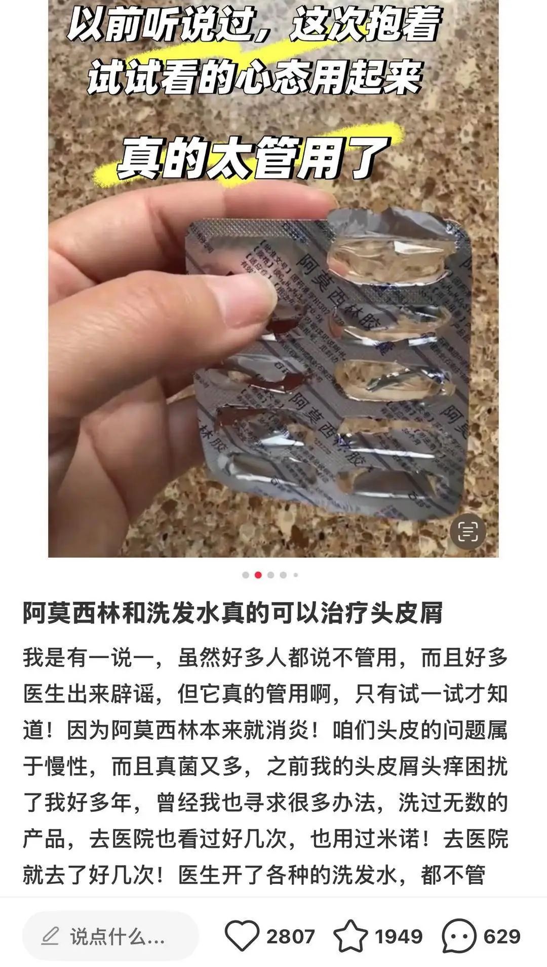 用阿莫西林洗头、洗洗衣机能杀菌？伪科学，没用且有害！
