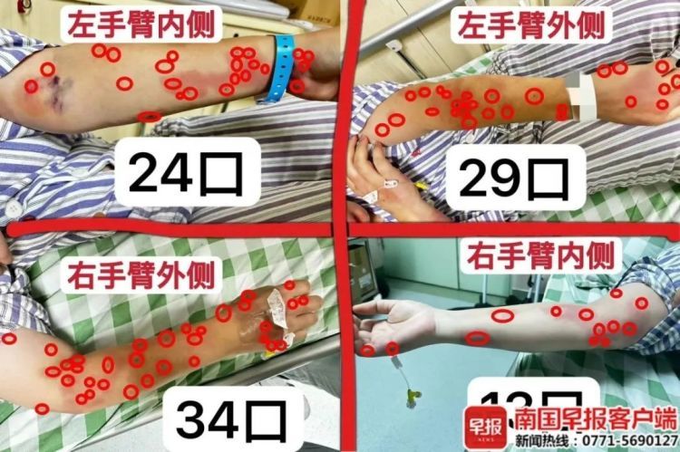 “太恐怖了”,女业主在小区遭蜂群袭击,紧急入院! “太恐怖了”,女业主在小区遭蜂群袭击,紧急入院!