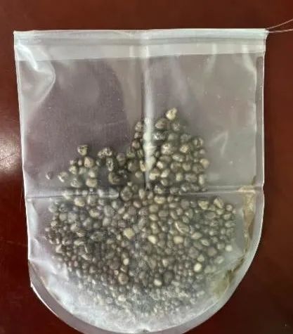 26岁，体内藏了上百颗“石头”？医生：这件事，很多人还在做