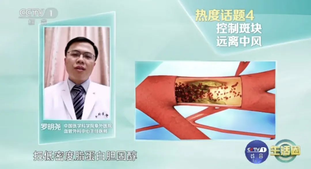 你的血管正在悄悄长斑变硬!这样做,“斑块”可能缩小或逆转 你的血管正在悄悄长斑变硬!这样做,“斑块”可能缩小或逆转