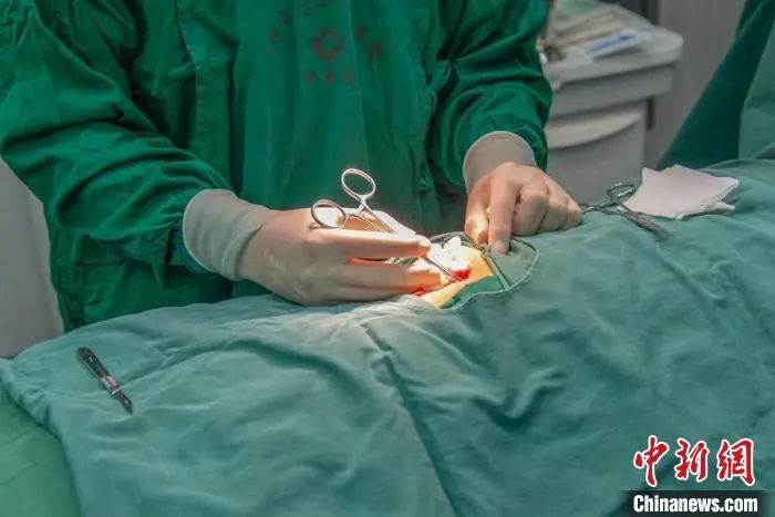 安徽首例“戒酒芯片”植入手术成功完成