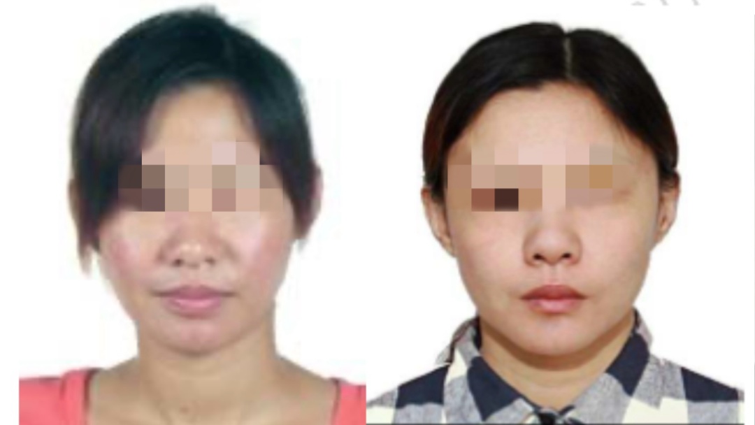 夫妻整容换脸潜逃10年，双双被抓！整容前后对比照曝光
