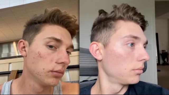 真心建议:这个年龄前控糖,效果最好!太多人都做晚了 真心建议:这个年龄前控糖,效果最好!太多人都做晚了