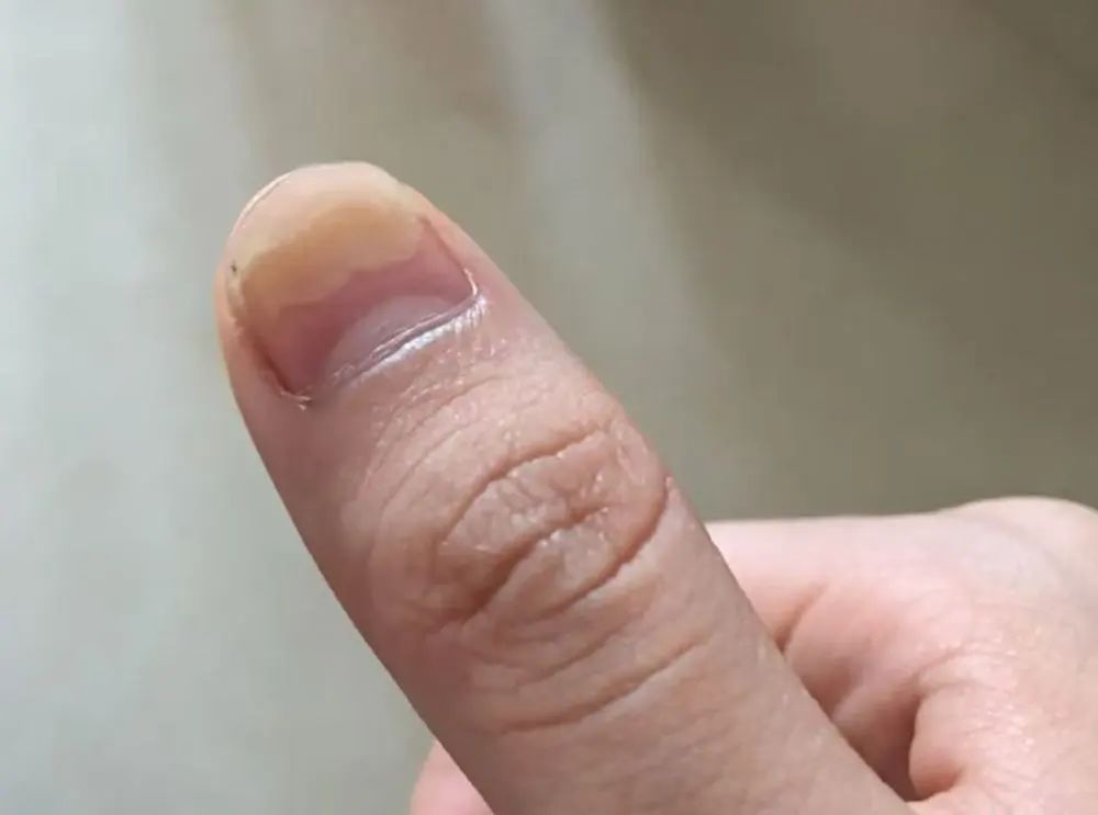 刚做两天的美甲，“发霉”了？