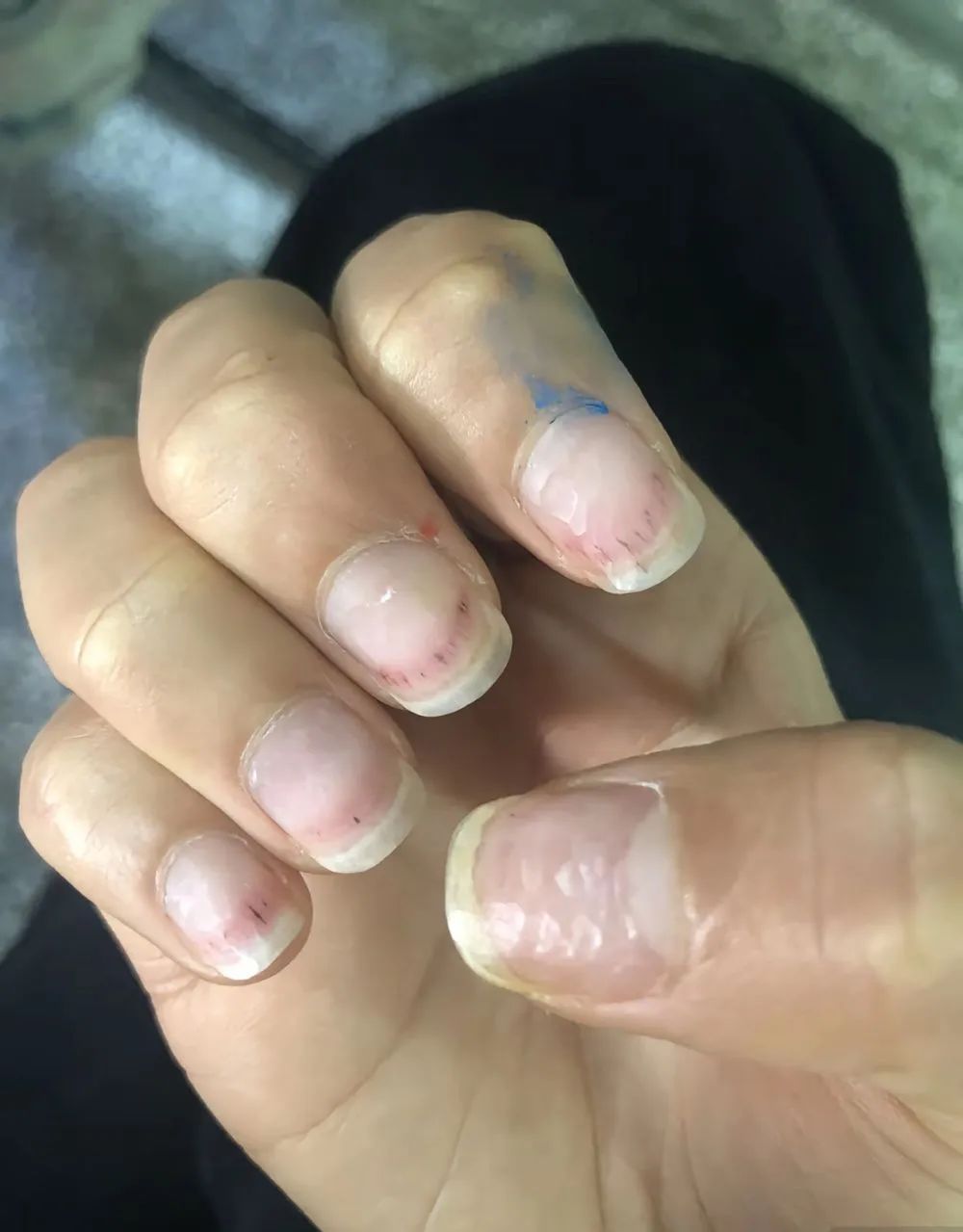 刚做两天的美甲，“发霉”了？