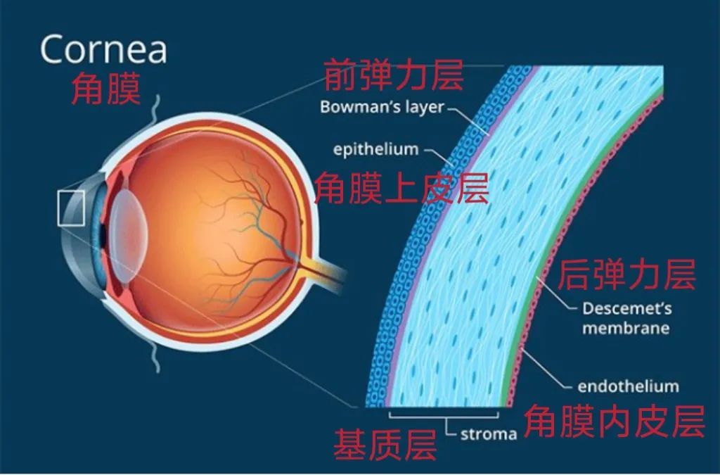 那些做了近视激光手术的人，后来怎么样了？