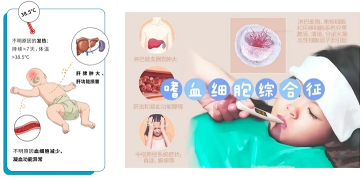 生命警报：噬血细胞综合征到底有多凶险？