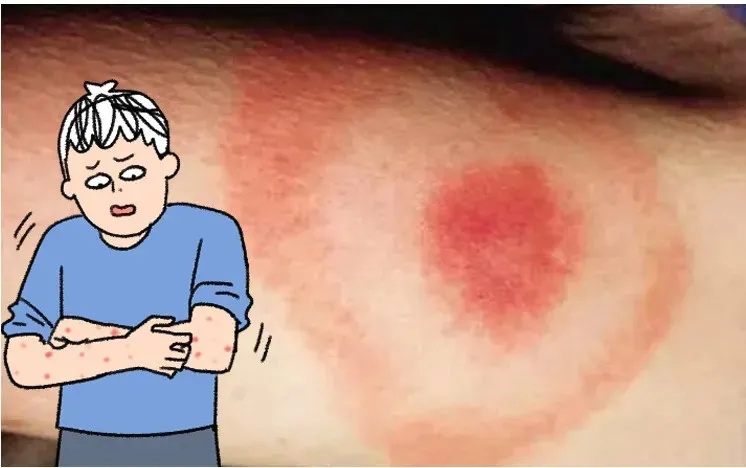 遇到这种诡异姿势的鸟，快跑，别好奇！