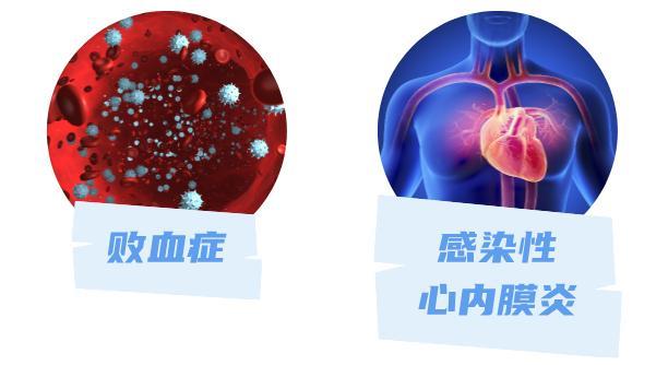 医生,揉眼睛居然有可能进ICU? 医生,揉眼睛居然有可能进ICU?