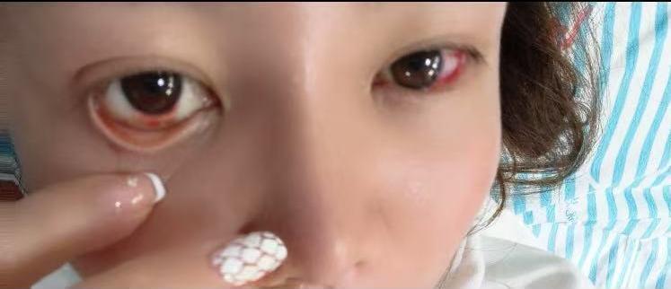 35岁女子家中洗澡疑热水器漏电，心脏骤停侥幸获救，专业人士：须选购带漏电保护装置