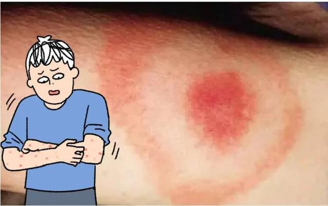 看到这种姿势的鸟千万别救!路边"诡异动物暗号"竟是索命警告 看到这种姿势的鸟千万别救!路边"诡异动物暗号"竟是索命警告