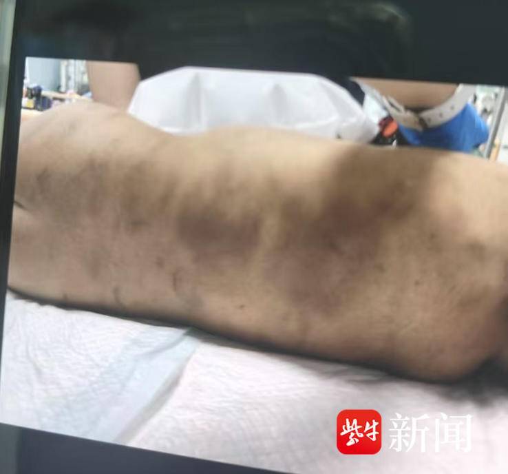 上海“3岁幼童被生父女友虐待致死案”将开庭，生母发声：孩子在医院躺了四天才收到通知