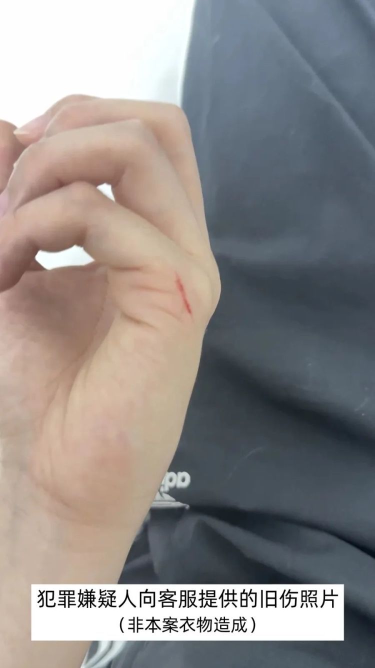 “穿搭博主”网购连帽衫，手被断针划伤？店家赔了4千余元，代工厂：并非自家针头！