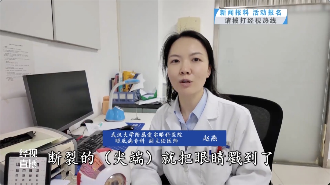 女子眼球被刺穿!医生提醒 女子眼球被刺穿!医生提醒