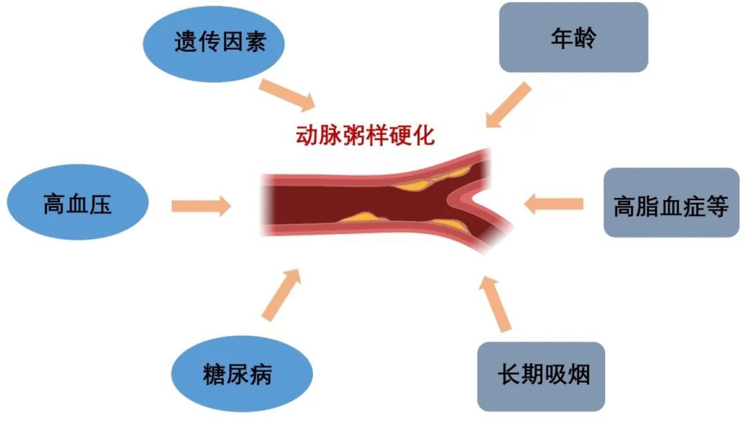 16岁高中生突然像变了个人:成绩下降,反应迟钝!医生:中风了 16岁高中生突然像变了个人:成绩下降,反应迟钝!医生:中风了