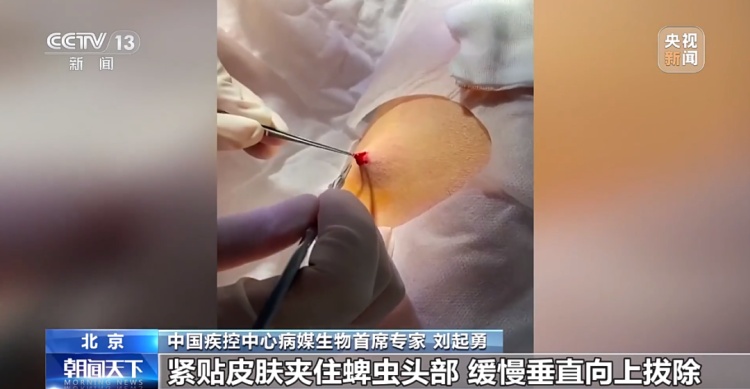 不要碰！路边遇到这种诡异姿势的鸟，赶紧远离！