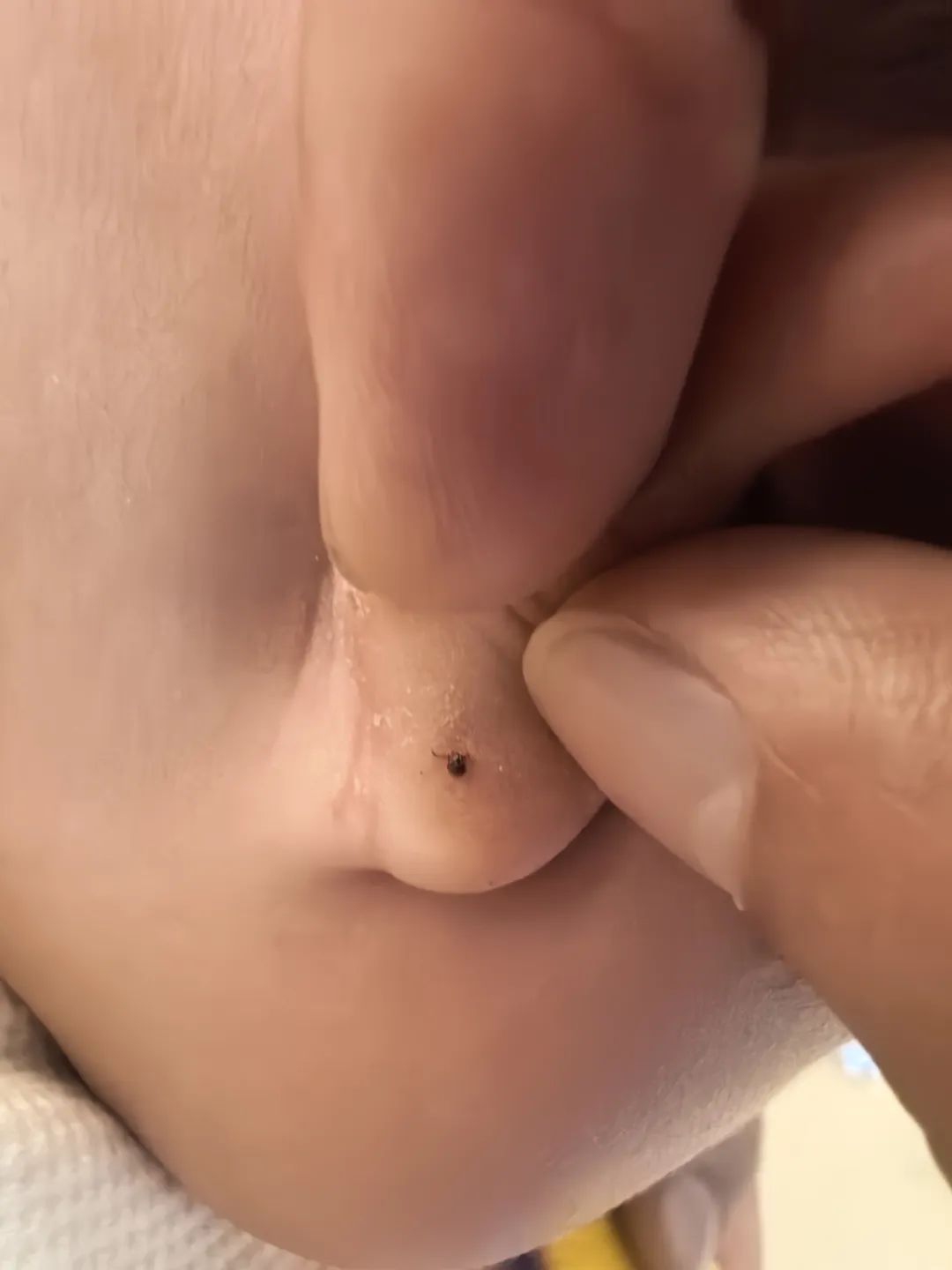 合肥一低龄婴儿罕见中招！高发期！医生发出提醒