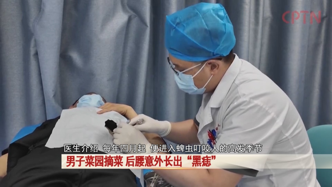 男子菜园摘菜，后腰意外长出“黑痣”！