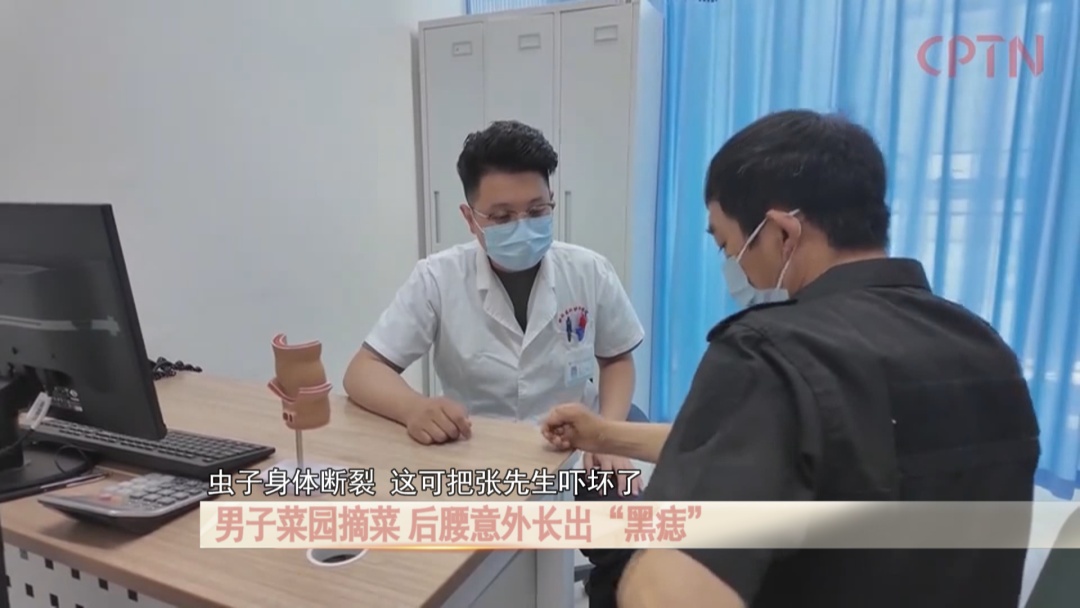 男子菜园摘菜，后腰意外长出“黑痣”！