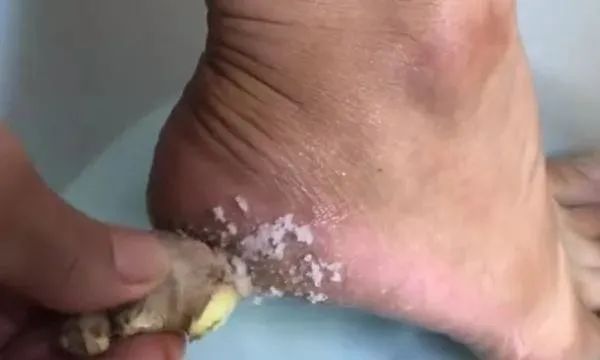 生姜加食盐混在一起，作用真厉害