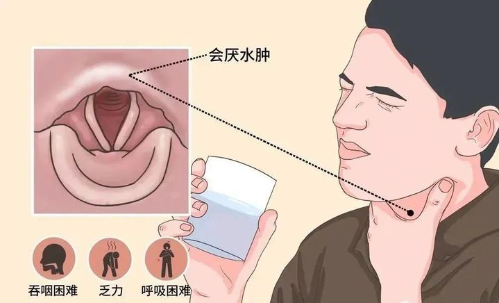 从就诊到去世仅10分钟！这种喉咙痛，别以为是感冒上火