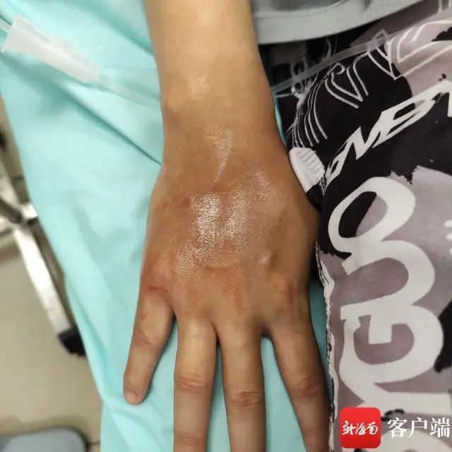 别碰！立即远离！近期广东这些地方已出现，严重可致命