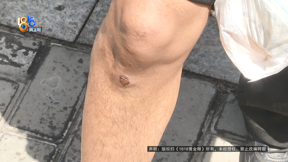 男子骑车经过餐厅被油污滑倒,讨说法竟演变成互吐口水!警方到场调解 男子骑车经过餐厅被油污滑倒,讨说法竟演变成互吐口水!警方到场调解