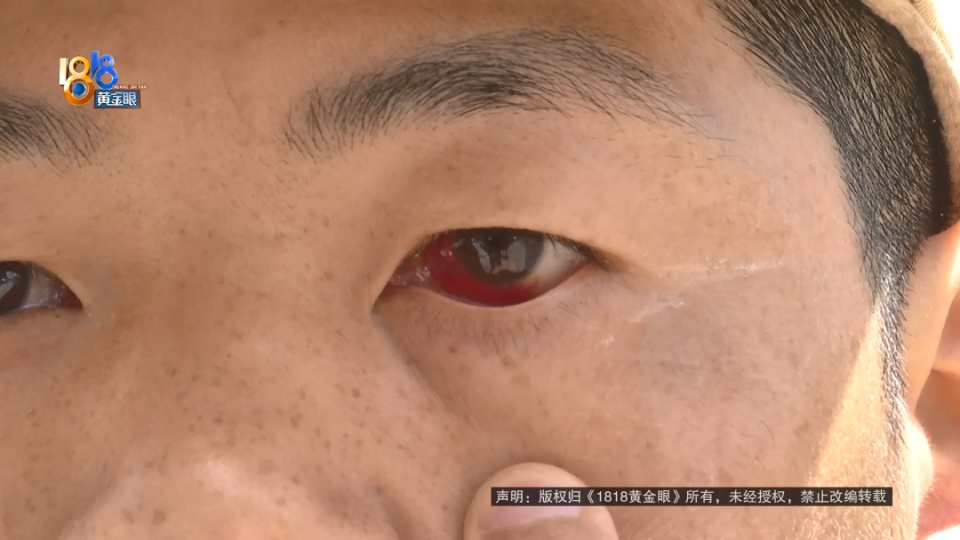 男子骑车经过餐厅被油污滑倒,讨说法竟演变成互吐口水!警方到场调解 男子骑车经过餐厅被油污滑倒,讨说法竟演变成互吐口水!警方到场调解