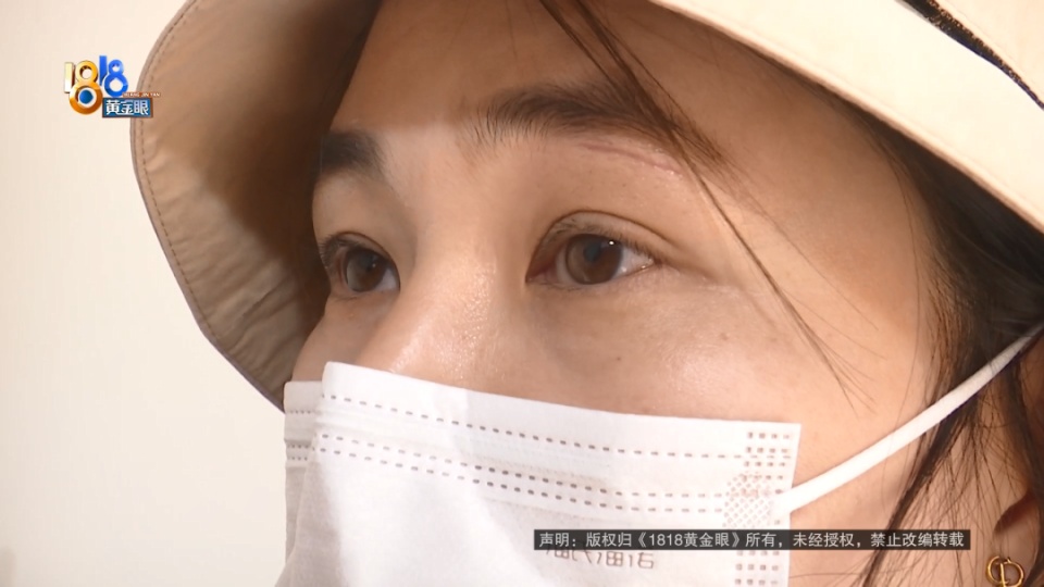 女子餐厅内撞上玻璃,香奈儿眼镜当场报废还缝了好几针,店家仅补偿400元? 女子餐厅内撞上玻璃,香奈儿眼镜当场报废还缝了好几针,店家仅补偿400元?