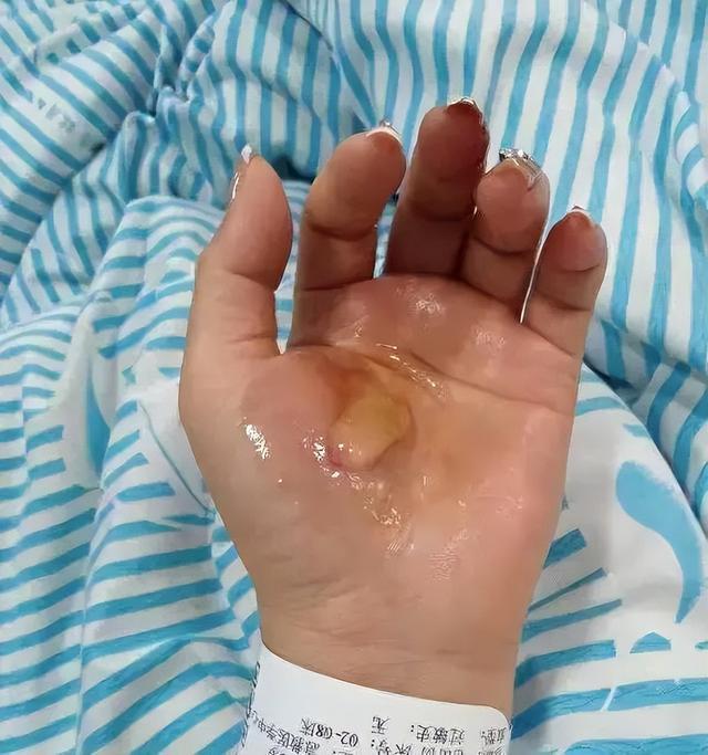 女子洗澡险丢命,只因家中缺少这一装置…… 女子洗澡险丢命,只因家中缺少这一装置……