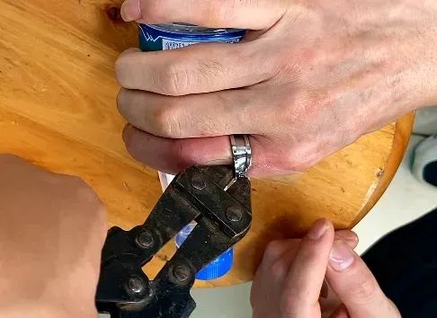 触目惊心！“刑具”勒紧血肉，102岁老人手指遭罪惊动119