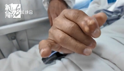 正大量上市！紧急提醒！有人吃了两顿就被送医，严重或累及全身，不可逆...