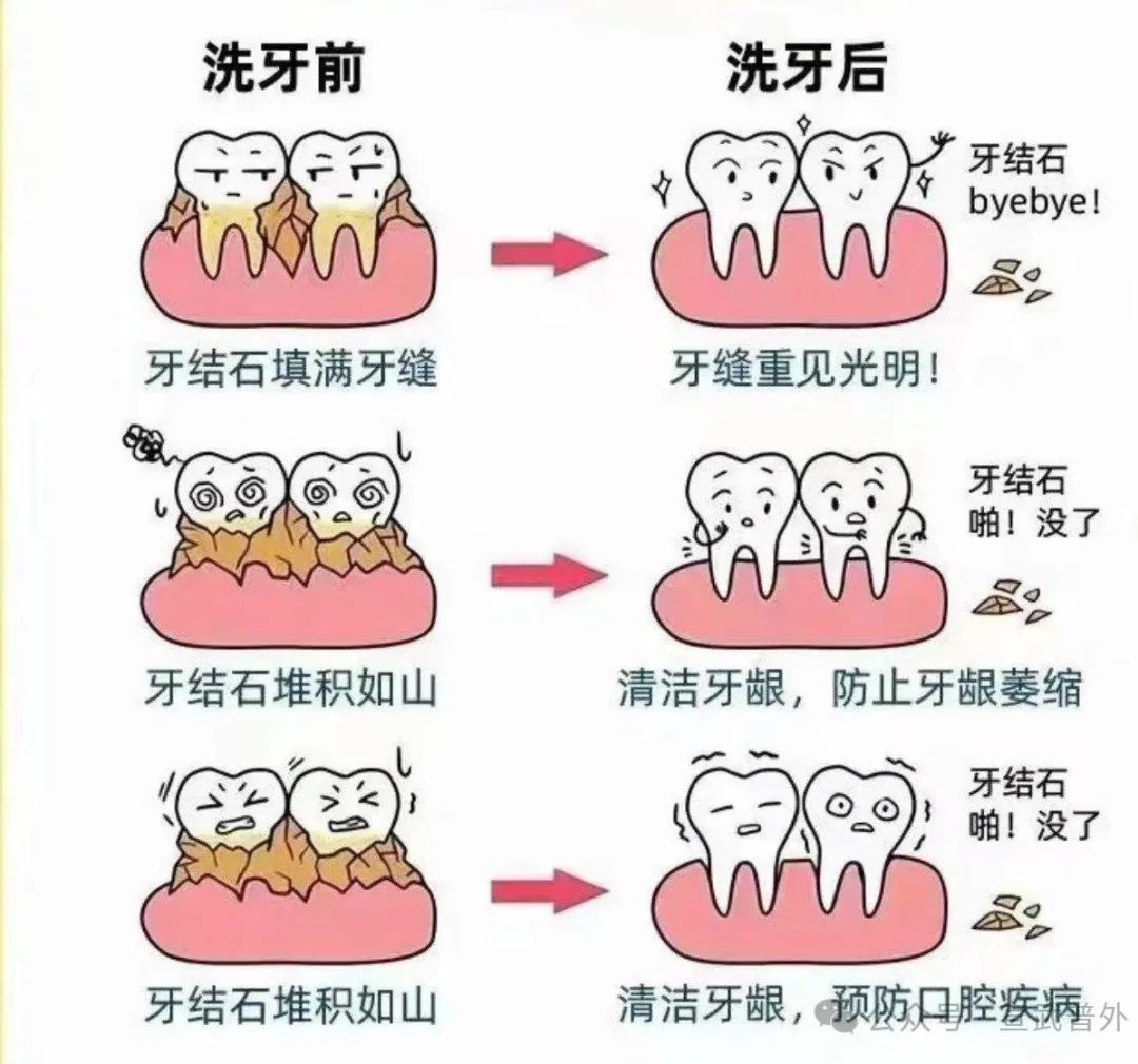 口腔健康很重要,正确护理是关键 口腔健康很重要,正确护理是关键
