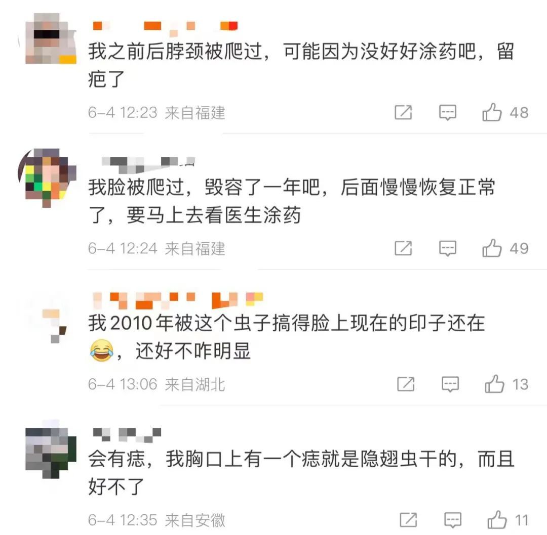 突然爆发，一地确诊200多例！有人差点毁容...医生紧急提醒：千万别拍