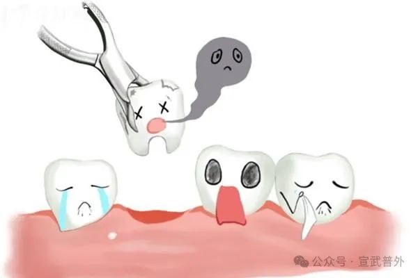化疗期间牙疼怎么办？